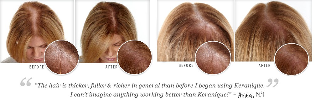 how to regrow hair after falling out